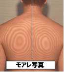 ゆがみの判定